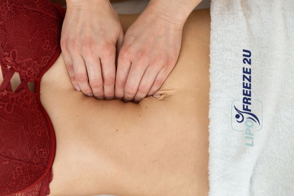 diastasis recti treatment Eastcote