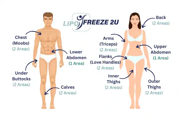 Areas you can have fat freezing treatment Eastcote