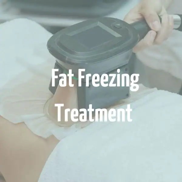 fat freezing treatment Eastcote