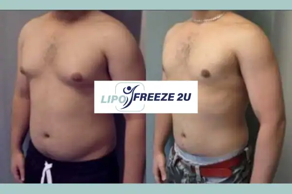 How Long Does It Take to See Results Eastcote?