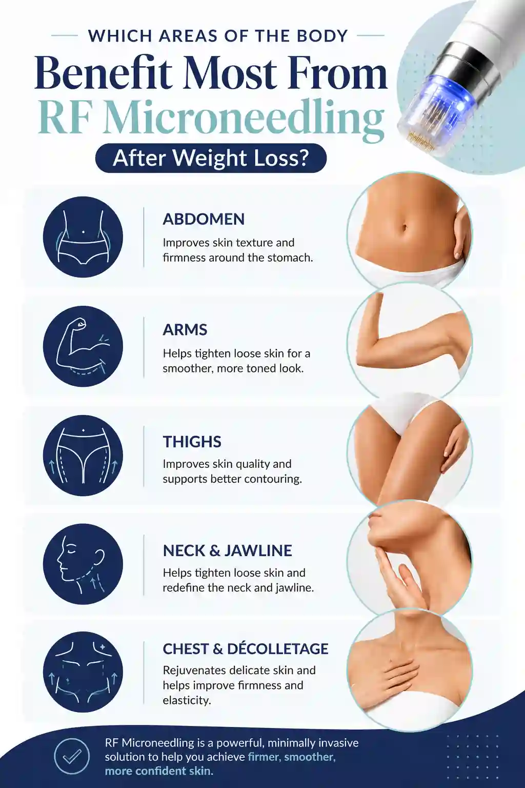Which Areas of the Body Benefit Most From RF Microneedling After Weight Loss Eastcote